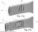 Fig. 18 - CRANIAL ORTHOSIS AND METHOD THEREFOR