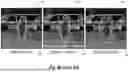Fig. 04 - MASK-ROBUST IMAGE INPAINTING UTILIZING MACHINE-LEARNING MODELS