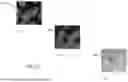 Fig. 04 - SYSTEMS AND METHODS FOR ELECTRON MICROSCOPY IMAGING