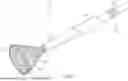 Fig. 02 - VACUUM ASSISTED OCCLUSION OF THE LEFT ATRIAL APPENDAGE