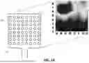Fig. 09 - MYOELECTRIC SENSING FOR PRECISION ELECTRICAL MUSCLE STIMULATION