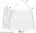 Fig. 07 - KNITTED COMPONENT WITH ADJUSTABLE TENSIONING SYSTEM