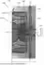 Fig. 01 - Devices And Methods For Occluding Abnormal Openings In A Patient's Vasculature