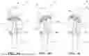 Fig. 05 - Robotic Hand-Held Surgical Instrument Systems And Methods