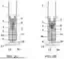Fig. 07 - INTEGRATED DEVICE AND SYSTEM FOR EPIDURAL INJECTION