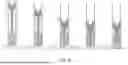 Fig. 09 - INTEGRATED DEVICE AND SYSTEM FOR EPIDURAL INJECTION