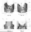 Fig. 07 - PIVOTAL BONE ANCHOR ASSEMBLIES WITH TWO-PIECE RECEIVERS, SEPARATE RETAINING STRUCTURES, AND BI-SPHERIC SHANK HEADS