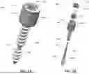Fig. 04 - SCREW IMPLANT AND METHODS FOR SAME