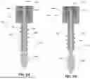 Fig. 05 - SCREW IMPLANT AND METHODS FOR SAME