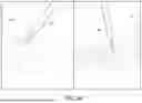 Fig. 09 - METHOD OF PERFORMING A MINIMALLY INVASIVE SPINAL SURGERY UTILIZING PEDICLE SCREW CORRIDORS