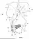 Fig. 02 - Fracture Fixation System