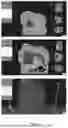 Fig. 07 - SYSTEM FOR VIRTUAL REALITY-BASED PREOPERATIVE SURGICAL PLANNING