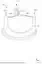 Fig. 01 - ADJUSTABLE HEART VALVE