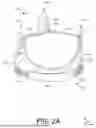 Fig. 03 - ADJUSTABLE HEART VALVE