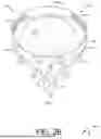 Fig. 04 - ADJUSTABLE HEART VALVE