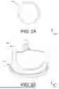 Fig. 28 - ADJUSTABLE HEART VALVE