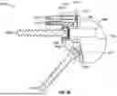 Fig. 45 - GLENOID IMPLANT