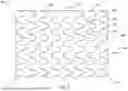 Fig. 03 - STENT SYSTEM