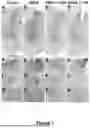 Fig. 08 - METHODS OF REDUCING ALPHA-SYNUCLEIN AGGREGATES IN THE BRAIN WITH L-TYROSINE