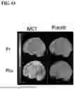 Fig. 14 - MCT FORMULATIONS FOR IMPROVING COGNITIVE FUNCTIONS
