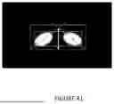 Fig. 46 - METHOD AND SYSTEM FOR SIZING A PATIENT INTERFACE