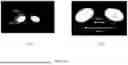 Fig. 49 - METHOD AND SYSTEM FOR SIZING A PATIENT INTERFACE