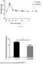 Fig. 02 - Novel Methods for Treating Glaucoma