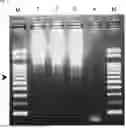 Fig. 06 - PRIMER SET, KIT FOR DETERMINING ONSET AND/OR ONSET RISK OF SPINAL MUSCULAR ATROPHY, AND METHOD FOR DETERMINING ONSET AND/OR ONSET RISK OF SPINAL MUSCULAR ATROPHY