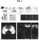 Fig. 09 - Method and System for Imaging and Analysis of a Biological Specimen