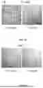 Fig. 28 - METHODS AND KITS FOR PREDICTING CANCER PROGNOSIS AND METASTASIS