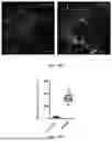 Fig. 45 - METHODS AND KITS FOR PREDICTING CANCER PROGNOSIS AND METASTASIS