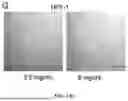 Fig. 60 - METHODS AND KITS FOR PREDICTING CANCER PROGNOSIS AND METASTASIS