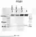 Fig. 70 - METHODS AND KITS FOR PREDICTING CANCER PROGNOSIS AND METASTASIS