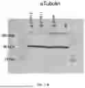 Fig. 71 - METHODS AND KITS FOR PREDICTING CANCER PROGNOSIS AND METASTASIS