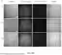 Fig. 83 - METHODS AND KITS FOR PREDICTING CANCER PROGNOSIS AND METASTASIS