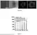 Fig. 89 - METHODS AND KITS FOR PREDICTING CANCER PROGNOSIS AND METASTASIS