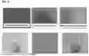 Fig. 06 - SYSTEMIC ORGANOID SIGNATURES CHIP AND METHODS OF USE