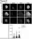 Fig. 09 - BIOMARKER FOR TYPE 1 DIABETES