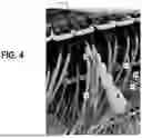 Fig. 05 - MULTI-FIBER PUSH ON (MPO) CONNECTOR MANIPULATION DEVICE AND METHODS OF USE