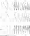 Fig. 01 - RANDOM NUMBER GENERATION