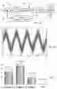 Fig. 02 - LOW POWER FILTERING OF PULSE DENSITY MODULATED DATA USING A DIGITAL FILTER WITH GRAY ENCODING/DECODING