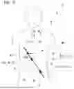 Fig. 09 - PUNCTURE SYSTEM, PUNCTURE ASSISTING TOOL, BODY SURFACE-IRRADIATING LASER MECHANISM, AND PUNCTURE NAVIGATION SYSTEM