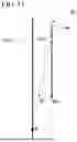 Fig. 13 - PUNCTURE SYSTEM, PUNCTURE ASSISTING TOOL, BODY SURFACE-IRRADIATING LASER MECHANISM, AND PUNCTURE NAVIGATION SYSTEM