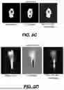 Fig. 22 - DENTAL RADIOGRAPHY METHOD WITH ENHANCED MATERIALS CHARACTERIZATION