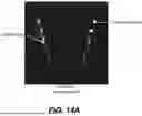 Fig. 35 - DENTAL RADIOGRAPHY METHOD WITH ENHANCED MATERIALS CHARACTERIZATION