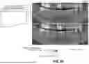 Fig. 49 - DENTAL RADIOGRAPHY METHOD WITH ENHANCED MATERIALS CHARACTERIZATION