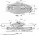 Fig. 02 - DEVICES FOR TREATING VASCULAR MALFORMATIONS