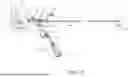 Fig. 02 - DEVICE AND METHOD FOR MANUAL ASPIRATION AND REMOVAL OF AN UNDESIRABLE MATERIAL