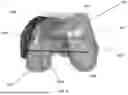 Fig. 07 - Fixation Plate And Method Of Stabilizing Fractured Bone