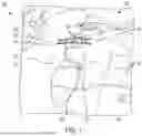 Fig. 02 - SYSTEM AND METHOD FOR CAVITY EXPANSION IN SURGICAL OPERATIONS